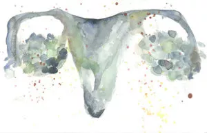 PCOS & infertility yinstill reproductive wellness